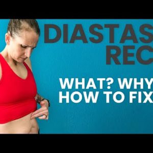 Diastasis Recti | Do You Have It? And How To Fix It!