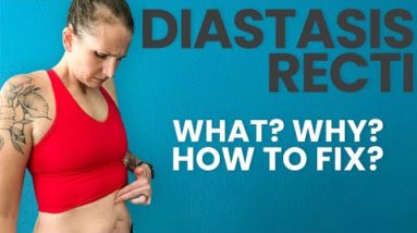 Diastasis Recti | Do You Have It? And How To Fix It!